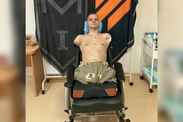 Приватбанк відмовився видати картку військовому з ампутаціями: деталі скандалу