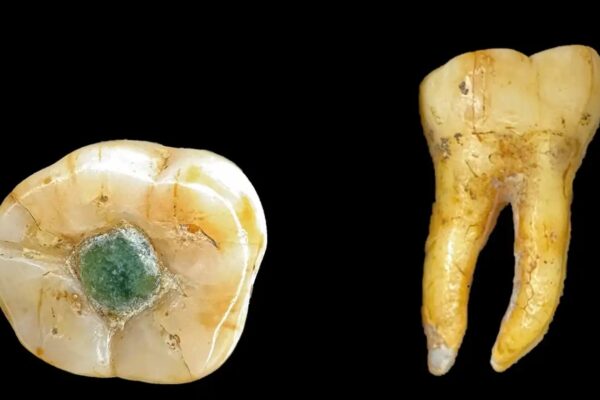 Давні мая використовували дорогоцінні камені як пломби